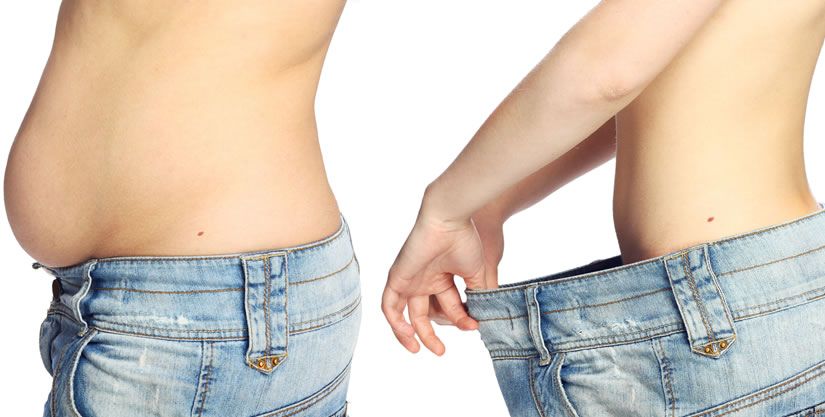 How Does Laser Lipolysis Work