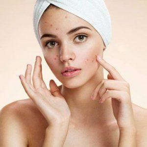 Acne Treatment in Dubai | Skin Care Clinic | Get Clear Skin